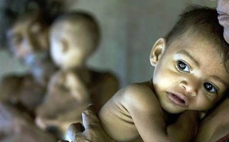 शिवपुरी में बढ़े कुपोषित बच्चे, किया जा रहा है उपचार