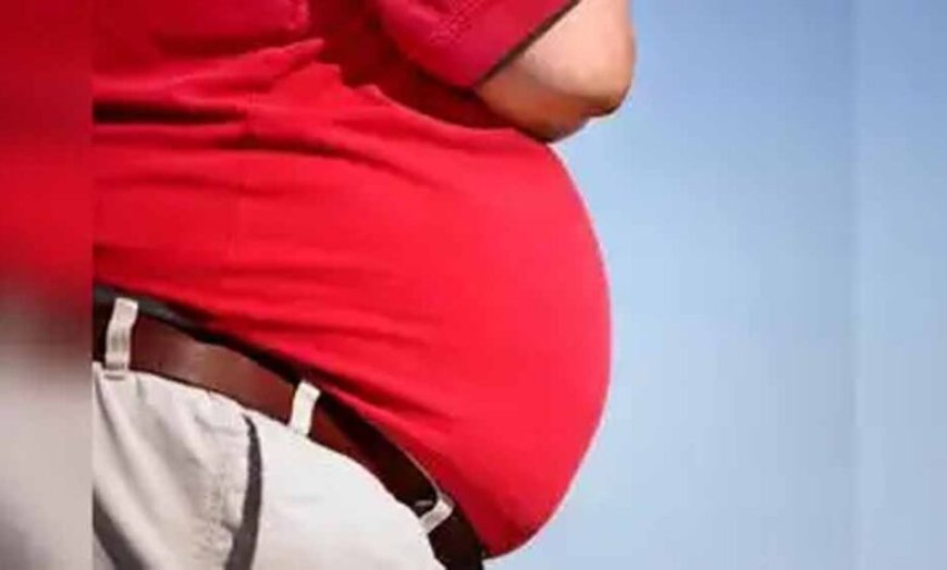 MP को मिलेगा पहला सरकारी ओबेसिटी क्लीनिक, जांच से सर्जरी तक सब फ्री