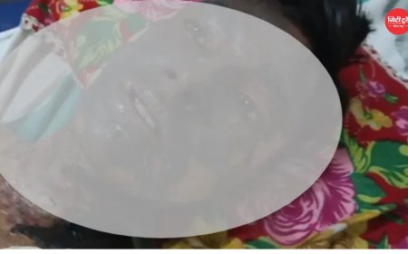 वाराणसी में आग से झुलसे किशोर की मौत, प्रेम संबंध से जुड़ा मामला, मौत से पहले दिए बयान की जांच में जुटी पुलिस