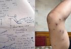 संसद मार्च पैलेट गन मामला: RAF जवान की पहचान, 7 राउंड फायरिंग का खुलासा; CRPF जांच में जुटी, रिपोर्ट जल्द