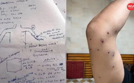 संसद मार्च पैलेट गन मामला: RAF जवान की पहचान, 7 राउंड फायरिंग का खुलासा; CRPF जांच में जुटी, रिपोर्ट जल्द