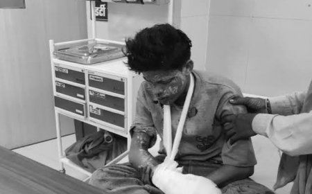 रायसेन में गज कुंडी में बारूद भरते समय विस्फोट:दो किशोर गंभीर रूप से झुलसे, सालेरा गांव की घटना; अस्पताल में इलाज जारी